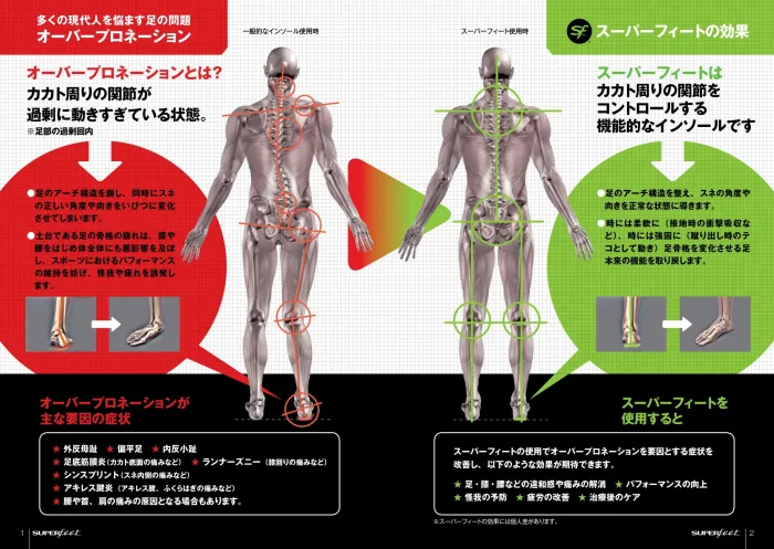 距骨下関節の過剰回内が全身に影響します