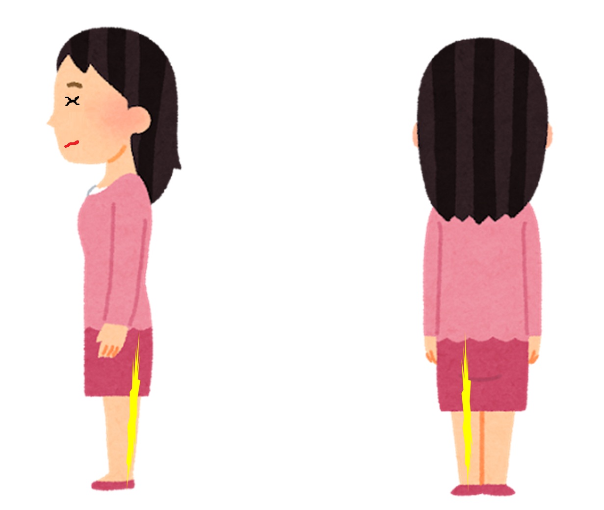 坐骨神経痛